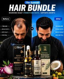 Hair Growth Oil &amp; Rosemary Hair Serum Bundle Set 45ML Each Bottle